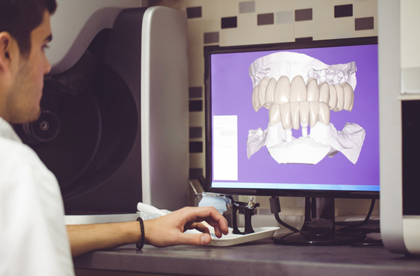 Man sitting at desk looking at a digital dental impression