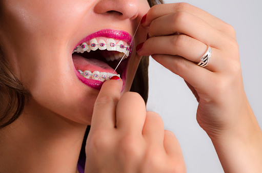 Girl flossing with braces